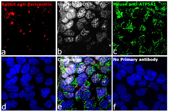 Rabbit IgG (H+L) Highly Cross-Adsorbed Secondary Antibody in Immunocytochemistry (ICC/IF)