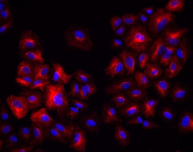Rabbit IgG (H+L) Highly Cross-Adsorbed Secondary Antibody in Immunocytochemistry (ICC/IF)