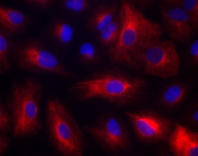 Rabbit IgG (H+L) Highly Cross-Adsorbed Secondary Antibody in Immunocytochemistry (ICC/IF)