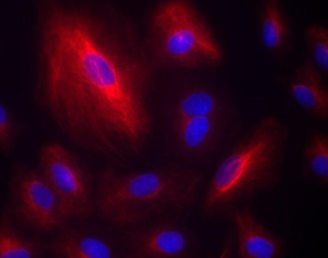 Rabbit IgG (H+L) Highly Cross-Adsorbed Secondary Antibody in Immunocytochemistry (ICC/IF)