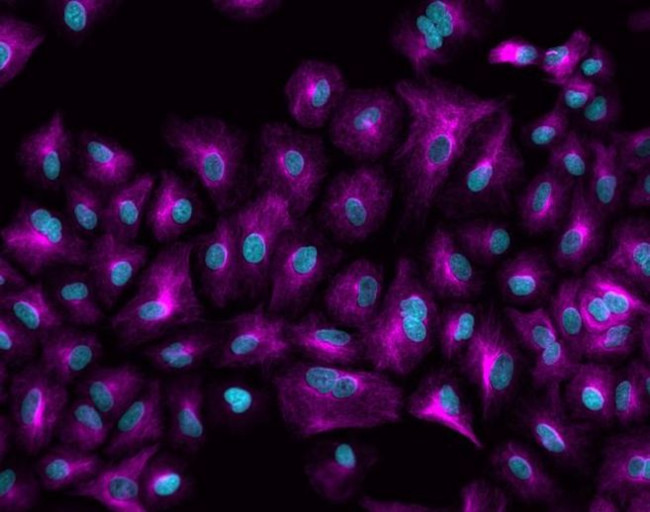 Rabbit IgG (H+L) Highly Cross-Adsorbed Secondary Antibody in Immunocytochemistry (ICC/IF)