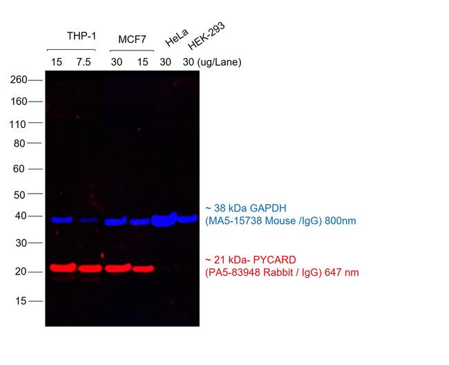 Rabbit IgG (H+L) Highly Cross-Adsorbed Secondary Antibody in Western Blot (WB)