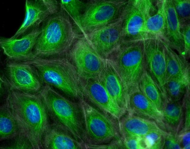 Goat IgG (H+L) Highly Cross-Adsorbed Secondary Antibody in Immunocytochemistry (ICC/IF)