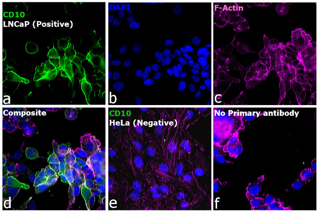 Goat IgG (H+L) Highly Cross-Adsorbed Secondary Antibody in Immunocytochemistry (ICC/IF)