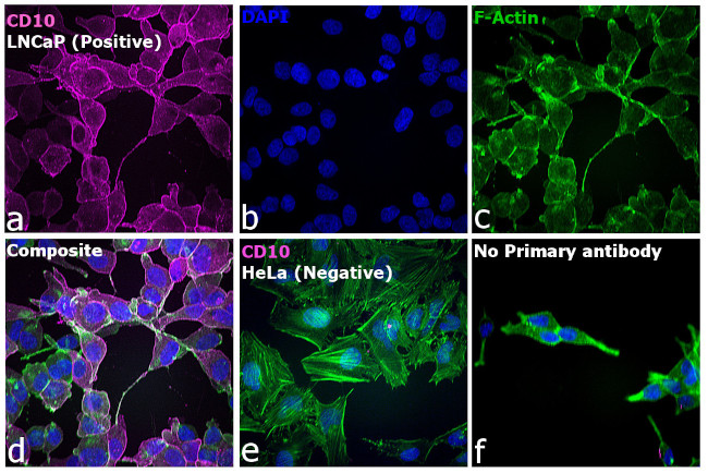 Goat IgG (H+L) Highly Cross-Adsorbed Secondary Antibody in Immunocytochemistry (ICC/IF)