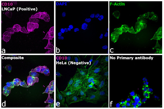 Goat IgG (H+L) Highly Cross-Adsorbed Secondary Antibody in Immunocytochemistry (ICC/IF)