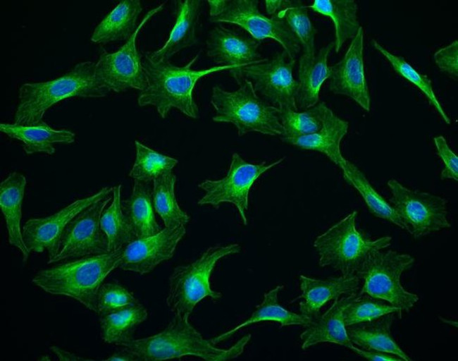 Chicken IgY (H+L) Cross-Adsorbed Secondary Antibody in Immunocytochemistry (ICC/IF)