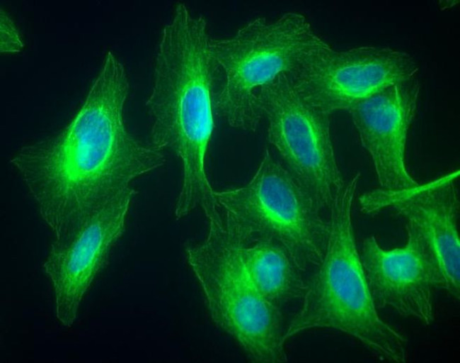 Chicken IgY (H+L) Cross-Adsorbed Secondary Antibody in Immunocytochemistry (ICC/IF)