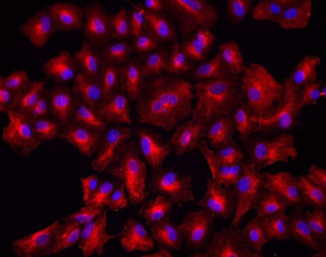 Chicken IgY (H+L) Cross-Adsorbed Secondary Antibody in Immunocytochemistry (ICC/IF)