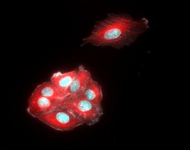 Chicken IgY (H+L) Cross-Adsorbed Secondary Antibody in Immunocytochemistry (ICC/IF)