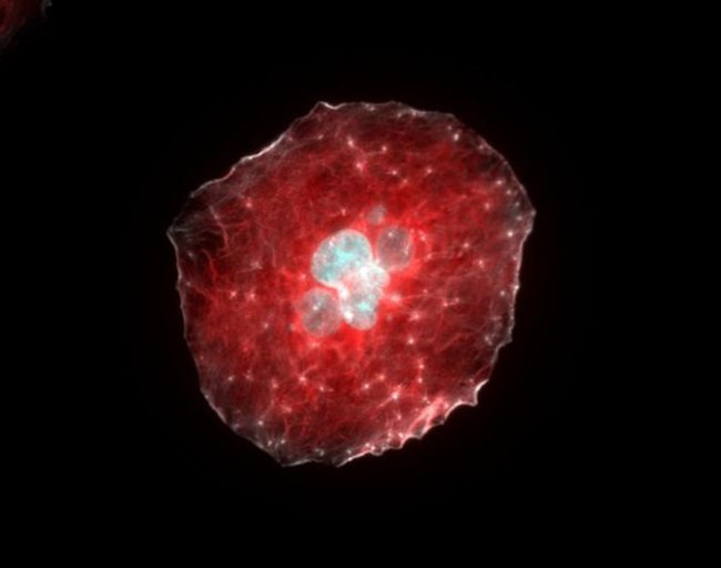 Chicken IgY (H+L) Cross-Adsorbed Secondary Antibody in Immunocytochemistry (ICC/IF)