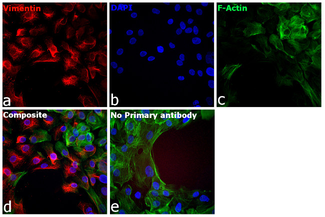 Chicken IgY (H+L) Cross-Adsorbed Secondary Antibody in Immunocytochemistry (ICC/IF)