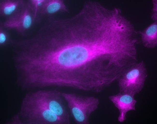 Chicken IgY (H+L) Cross-Adsorbed Secondary Antibody in Immunocytochemistry (ICC/IF)