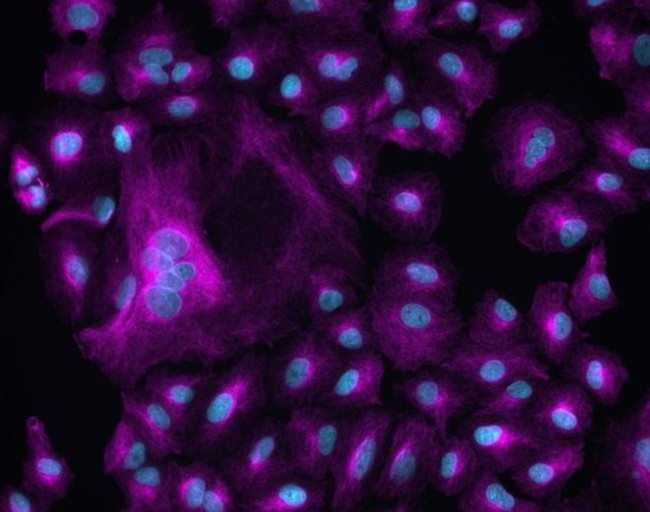 Chicken IgY (H+L) Cross-Adsorbed Secondary Antibody in Immunocytochemistry (ICC/IF)