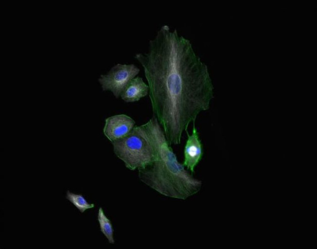 Chicken IgY (H+L) Cross-Adsorbed Secondary Antibody in Immunocytochemistry (ICC/IF)