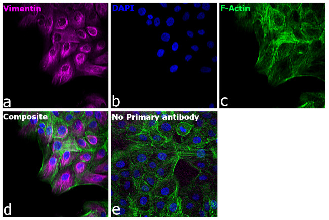 Chicken IgY (H+L) Cross-Adsorbed Secondary Antibody in Immunocytochemistry (ICC/IF)