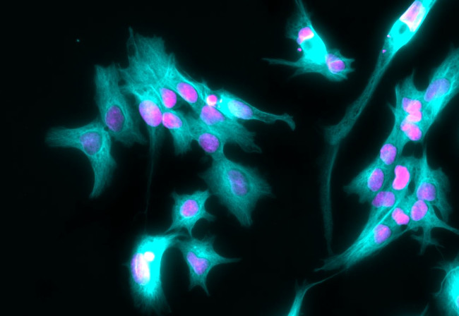 Rabbit IgG (H+L) Highly Cross-Adsorbed Secondary Antibody in Immunocytochemistry (ICC/IF)