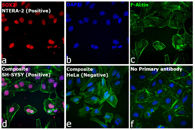 Rat IgG (H+L) Highly Cross-Adsorbed Secondary Antibody in Immunocytochemistry (ICC/IF)