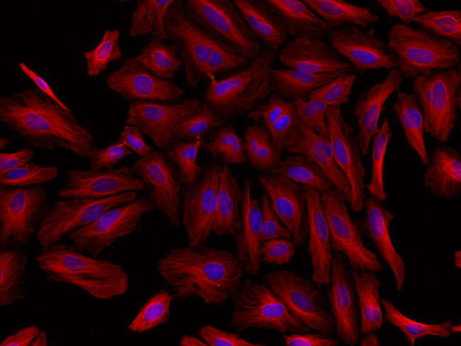 Rat IgG (H+L) Highly Cross-Adsorbed Secondary Antibody in Immunocytochemistry (ICC/IF)