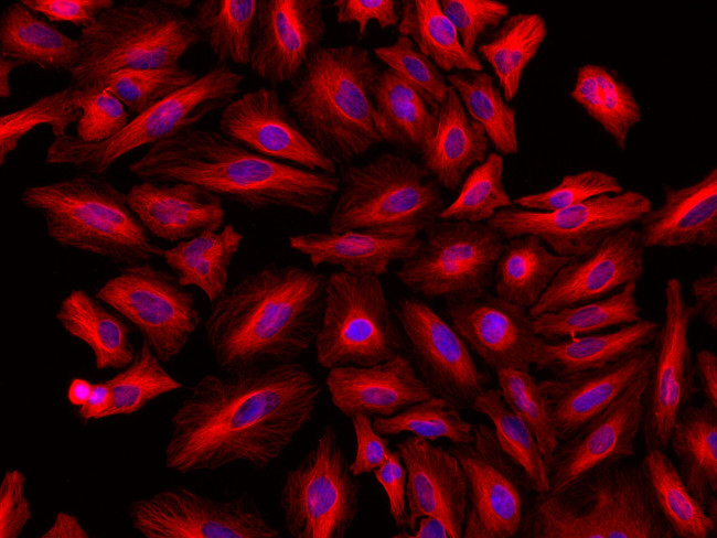 Rat IgG (H+L) Highly Cross-Adsorbed Secondary Antibody in Immunocytochemistry (ICC/IF)