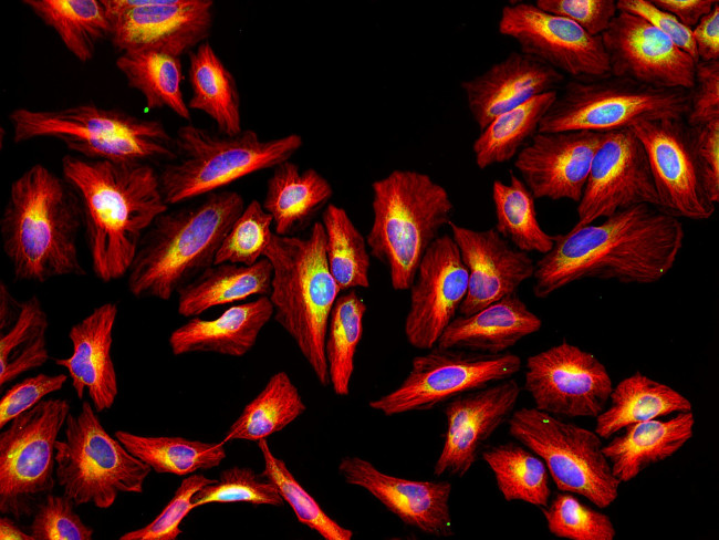 Rat IgG (H+L) Highly Cross-Adsorbed Secondary Antibody in Immunocytochemistry (ICC/IF)