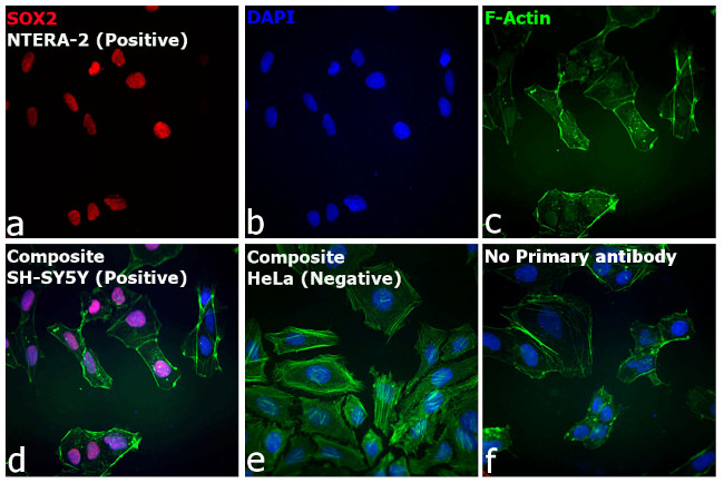 Rat IgG (H+L) Highly Cross-Adsorbed Secondary Antibody in Immunocytochemistry (ICC/IF)