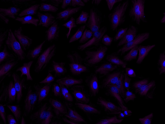 Rat IgG (H+L) Highly Cross-Adsorbed Secondary Antibody in Immunocytochemistry (ICC/IF)