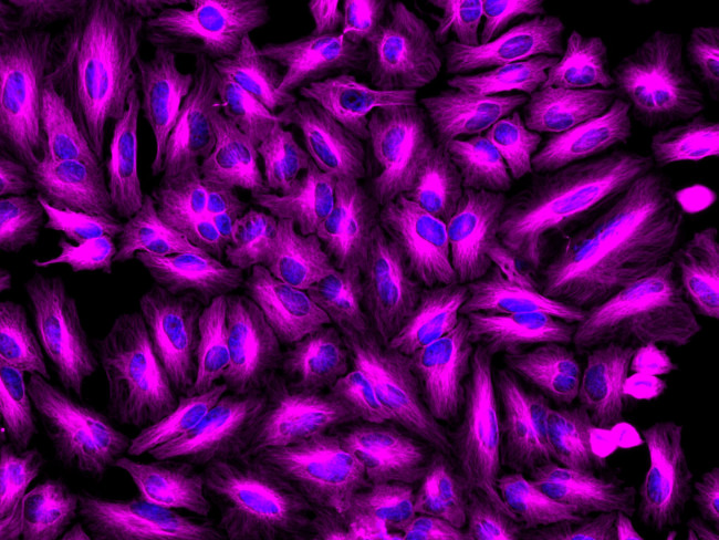 Rat IgG (H+L) Highly Cross-Adsorbed Secondary Antibody in Immunocytochemistry (ICC/IF)