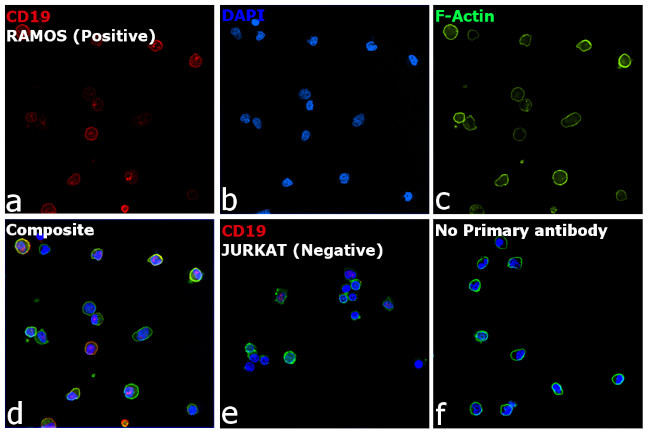 Rat IgG (H+L) Highly Cross-Adsorbed Secondary Antibody in Immunocytochemistry (ICC/IF)