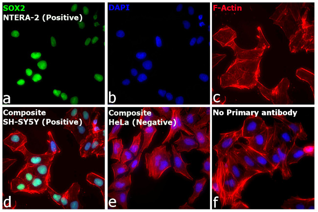 Rat IgG (H+L) Highly Cross-Adsorbed Secondary Antibody in Immunocytochemistry (ICC/IF)