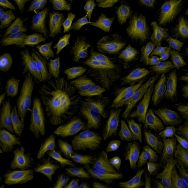 Rat IgG (H+L) Highly Cross-Adsorbed Secondary Antibody in Immunocytochemistry (ICC/IF)