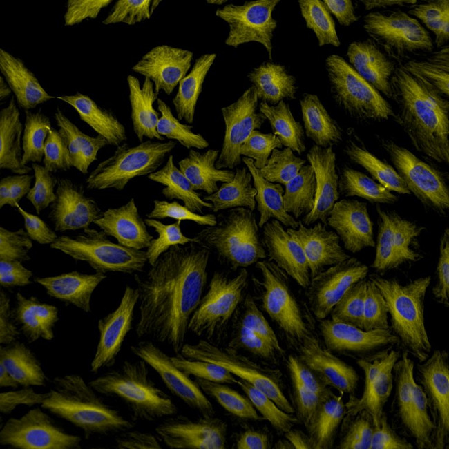 Rat IgG (H+L) Highly Cross-Adsorbed Secondary Antibody in Immunocytochemistry (ICC/IF)