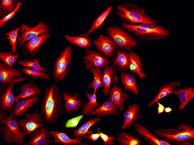 Rat IgG (H+L) Highly Cross-Adsorbed Secondary Antibody in Immunocytochemistry (ICC/IF)