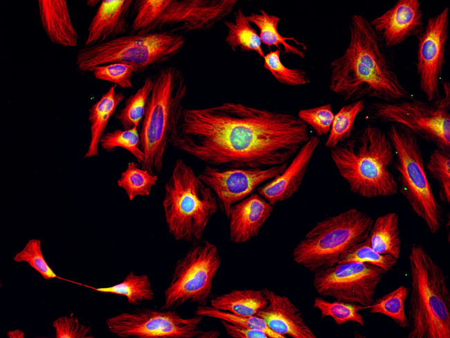 Rat IgG (H+L) Highly Cross-Adsorbed Secondary Antibody in Immunocytochemistry (ICC/IF)