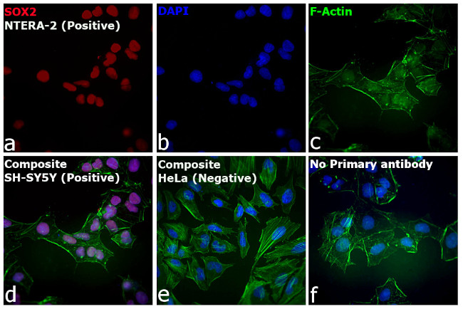 Rat IgG (H+L) Highly Cross-Adsorbed Secondary Antibody in Immunocytochemistry (ICC/IF)