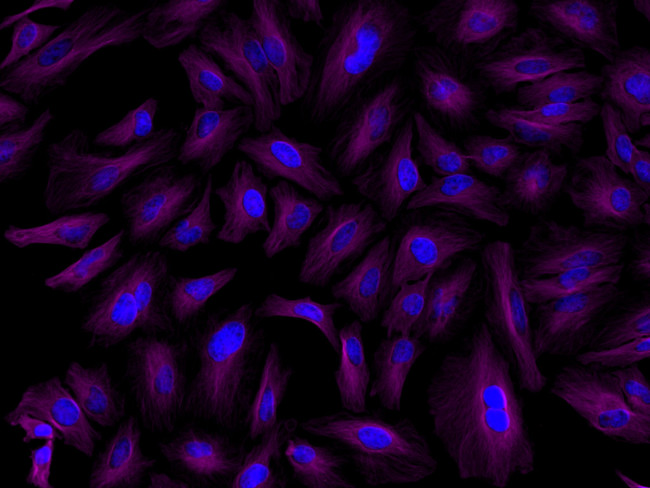 Rat IgG (H+L) Highly Cross-Adsorbed Secondary Antibody in Immunocytochemistry (ICC/IF)