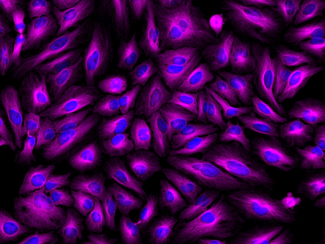 Rat IgG (H+L) Highly Cross-Adsorbed Secondary Antibody in Immunocytochemistry (ICC/IF)