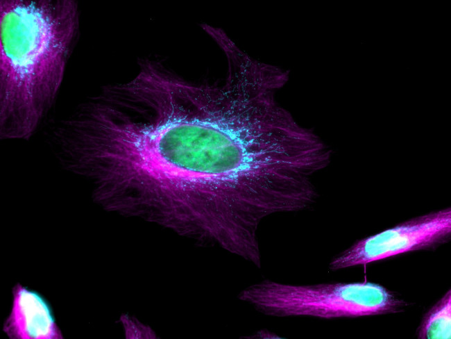 Rat IgG (H+L) Highly Cross-Adsorbed Secondary Antibody in Immunocytochemistry (ICC/IF)