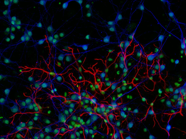 Rat IgG (H+L) Highly Cross-Adsorbed Secondary Antibody in Immunocytochemistry (ICC/IF)