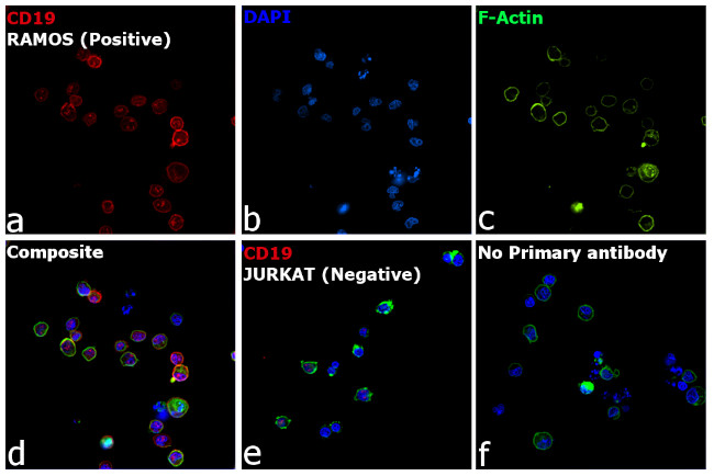 Rat IgG (H+L) Highly Cross-Adsorbed Secondary Antibody in Immunocytochemistry (ICC/IF)