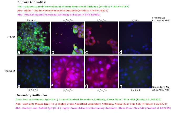 Human IgG (H+L) Cross-Adsorbed Secondary Antibody in Immunocytochemistry (ICC/IF)