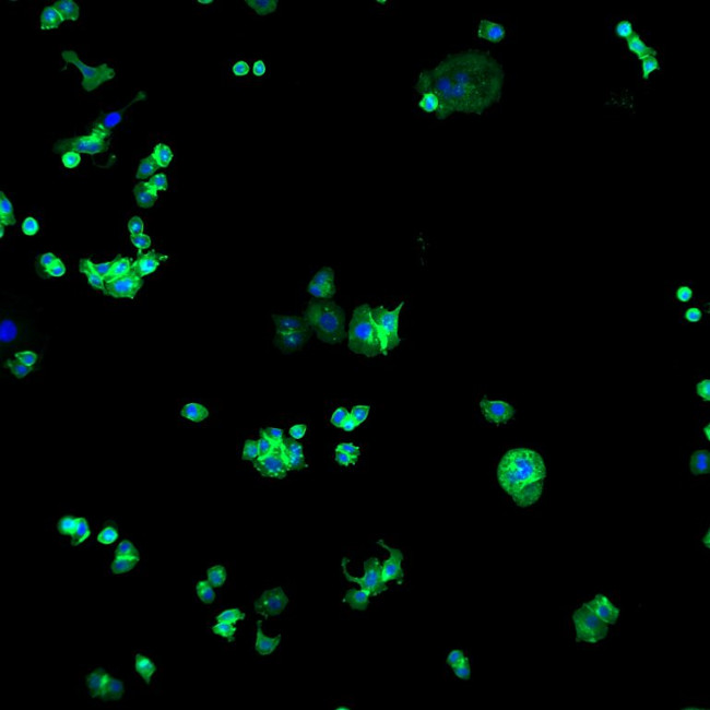 Human IgG (H+L) Cross-Adsorbed Secondary Antibody in Immunocytochemistry (ICC/IF)