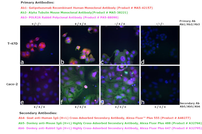 Human IgG (H+L) Cross-Adsorbed Secondary Antibody in Immunocytochemistry (ICC/IF)