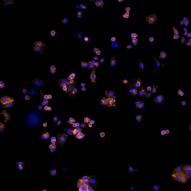 Human IgG (H+L) Cross-Adsorbed Secondary Antibody in Immunocytochemistry (ICC/IF)