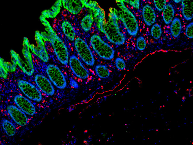 Mouse IgG (H+L) Cross-Adsorbed Secondary Antibody in Immunohistochemistry (Paraffin) (IHC (P))