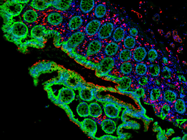 Mouse IgG (H+L) Cross-Adsorbed Secondary Antibody in Immunohistochemistry (Paraffin) (IHC (P))