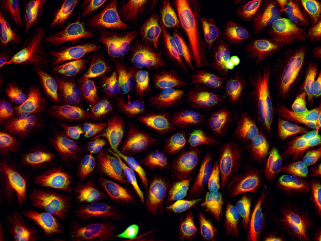 Mouse IgG (H+L) Cross-Adsorbed Secondary Antibody in Immunocytochemistry (ICC/IF)