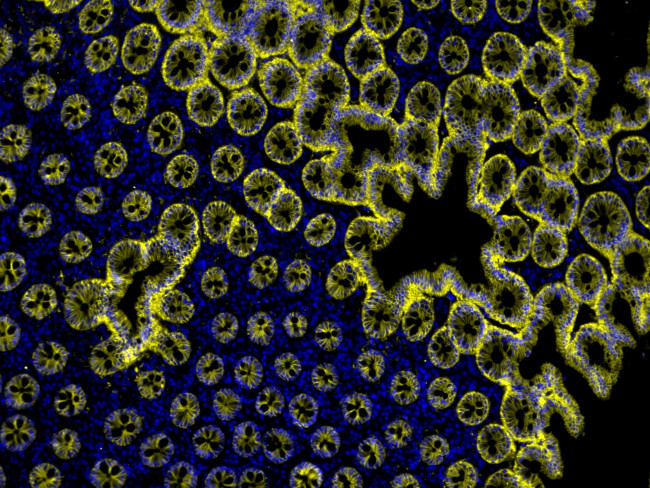 Mouse IgG (H+L) Cross-Adsorbed Secondary Antibody in Immunohistochemistry (Paraffin) (IHC (P))