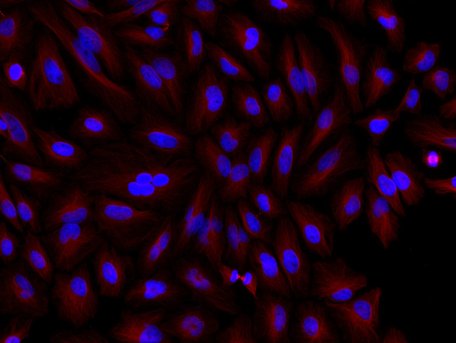 Mouse IgG (H+L) Cross-Adsorbed Secondary Antibody in Immunocytochemistry (ICC/IF)