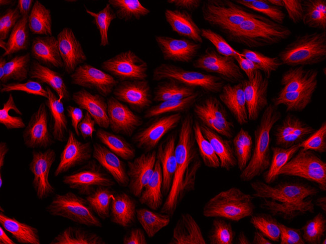 Mouse IgG (H+L) Cross-Adsorbed Secondary Antibody in Immunocytochemistry (ICC/IF)